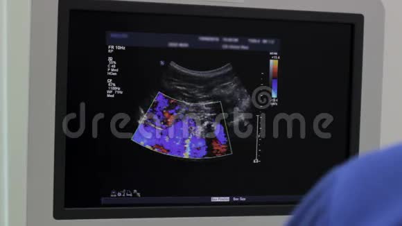 超声检查装置监测特写人体器官颜色视频的预览图