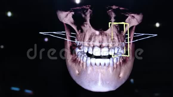 3D牙科数字建模修复三维牙齿模型病人扫描牙齿医生正在研究视频的预览图