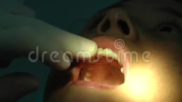 牙医的小女孩视频的预览图