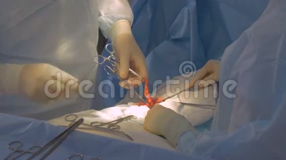 外科医生团队动手做手术快关门视频的预览图