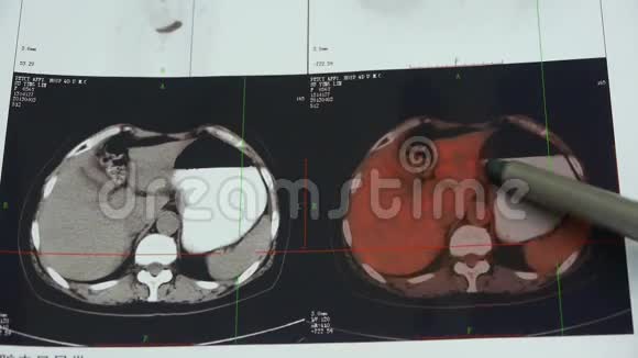 医生研究彩色胃胰宠物ct扫描人体器官X线摄影视频的预览图