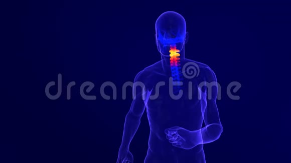 颈部脊柱疼痛的X线动画视频的预览图
