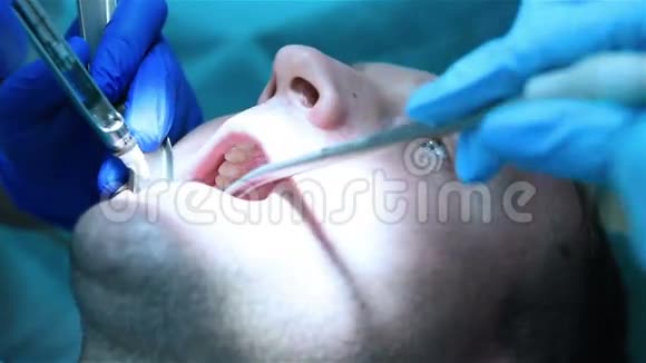 牙科麻醉注射视频的预览图