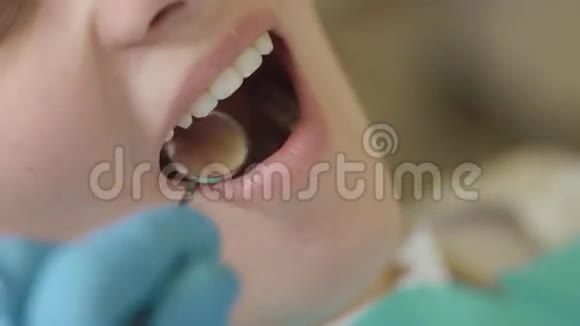 口腔和牙齿的检查在口腔检查过程中病人年轻女孩张口闭口视频的预览图