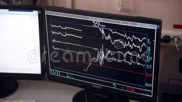 无法识别的医生控制在医院手术室的操作在计算机屏幕上进行视频的预览图