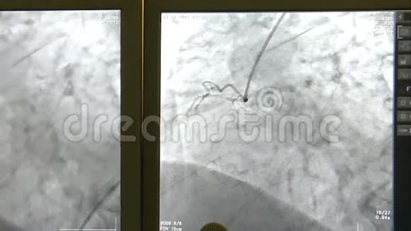 手术室的监视器视频的预览图
