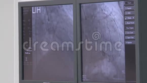 手术室的监视器视频的预览图