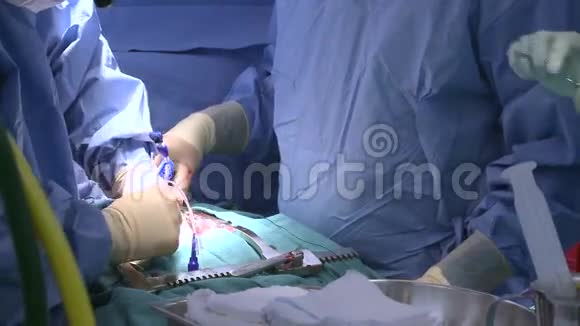 外科医生一起在手术室工作视频的预览图