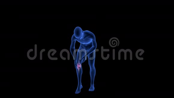 膝盖疼痛蓝色人体解剖体三维扫描渲染旋转无缝环视频的预览图