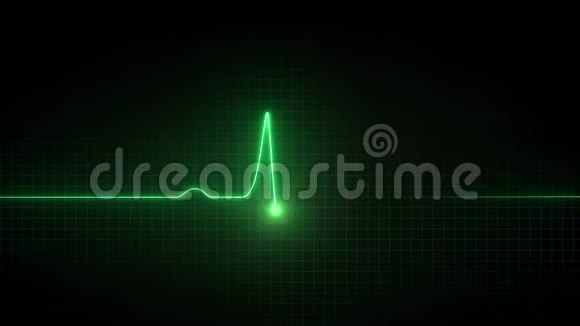 心电图循环屏幕上的Cardoigram曲线视频的预览图