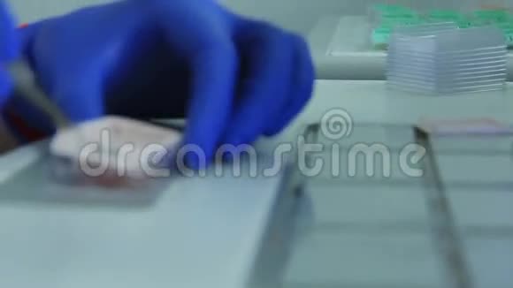 病理形态学实验室样品放置在胶囊中在杜莉上视频的预览图