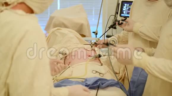 手术室的团队外科医生视频的预览图