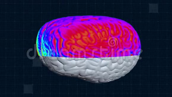 脑MRT扫描全高清医学背景视频的预览图