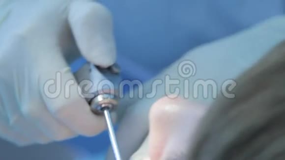 口腔内的牙医视频的预览图