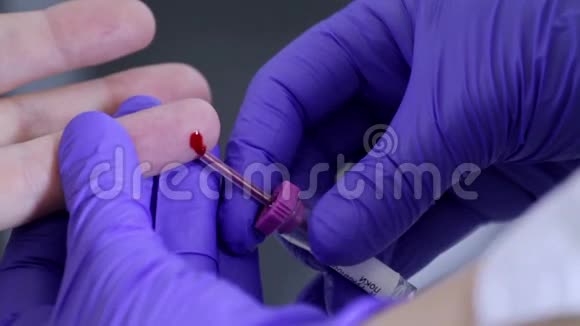 护士用手指抽取血液样本视频的预览图