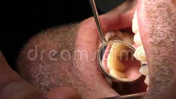 牙科男性口腔牙齿护理视频的预览图