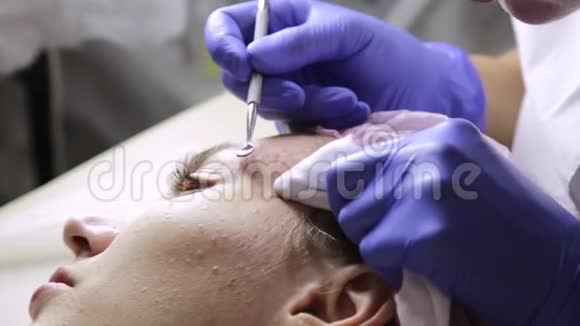 美容师在美容院为年轻的沃南捏粉刺黑头面部皮肤护理视频的预览图