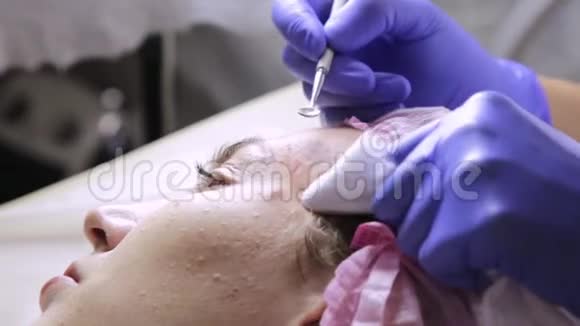 美容师在美容院为年轻的沃南捏粉刺黑头面部皮肤护理视频的预览图