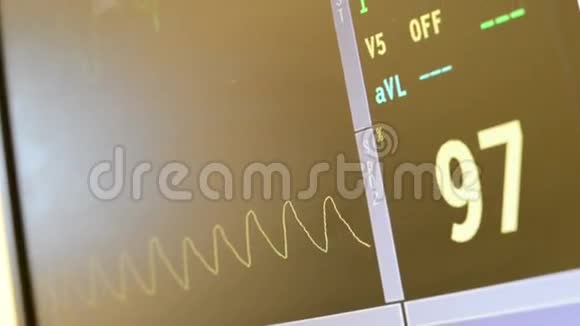 手术室及急诊室的心率监测显示心跳视频的预览图