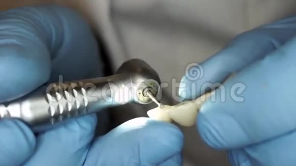 戴手套的牙医调整牙科假体视频的预览图