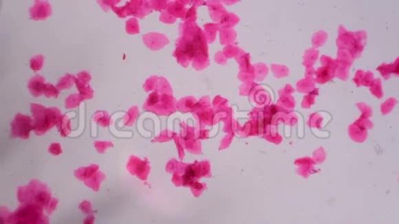 显微镜下的多个鳞状上皮白色背景上的抽象粉红色点视频的预览图