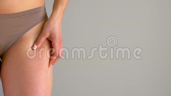 女性臀部拉伸痕迹和皮肤上的脂肪团视频的预览图