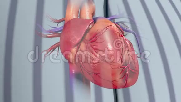 不稳定型心绞痛视频的预览图