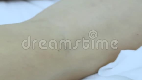 临床用水蛭疗法女性皮肤蛭视频的预览图