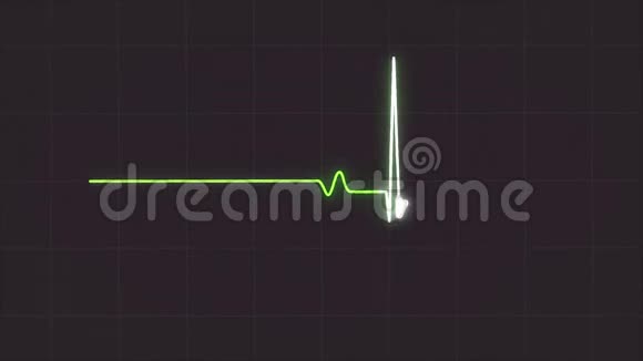 摘要心电图显示心脏跳动在灰色背景动中心电图绿色脉搏波视频的预览图