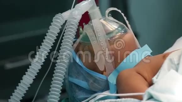带氧气面罩的不明儿童准备手术视频的预览图