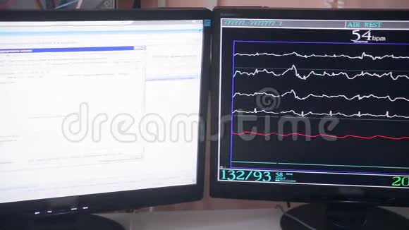 心脏造影在一家心脏病医院做心脏检查视频的预览图