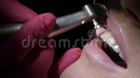牙医为病人做牙齿清洁视频的预览图