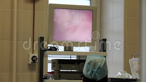 外科医生看着监视器视频的预览图