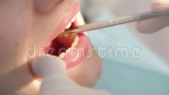 口腔和牙齿的检查视频的预览图