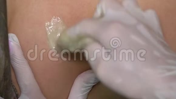 手套中的美容师将男性背部涂上糖男性美容治疗视频的预览图