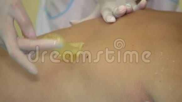 手套中的美容师将男性背部涂上糖男性美容治疗视频的预览图
