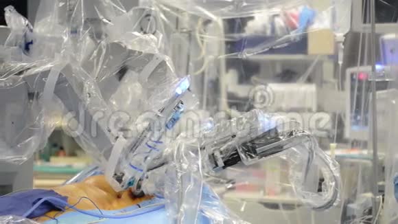 手术套房与机器人手术机视频的预览图