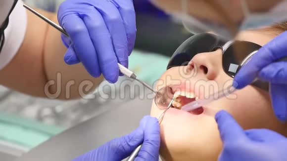 牙科诊所牙齿钻孔治疗过程中的儿童特写视频的预览图