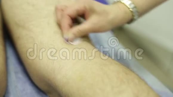 在病人足部安装医用针头视频的预览图