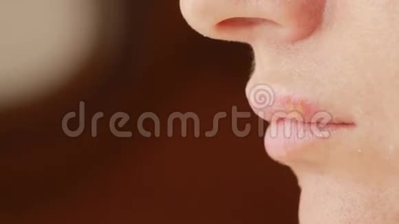 女孩在嘴唇上碰疮疱疹口唇治疗视频的预览图
