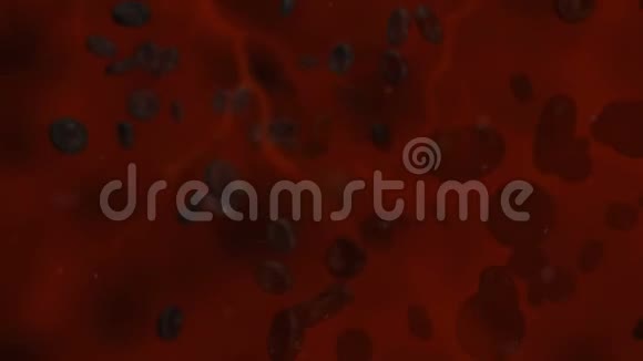 人体内的病态血细胞视频的预览图