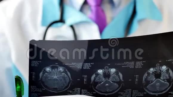 医生放射科医生检查MRI或CT扫描视频的预览图