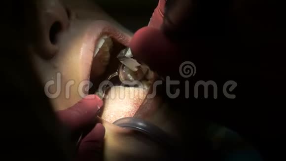年轻女子从牙医那里治疗牙齿视频的预览图