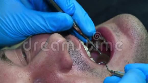 牙医的牙齿检查视频的预览图
