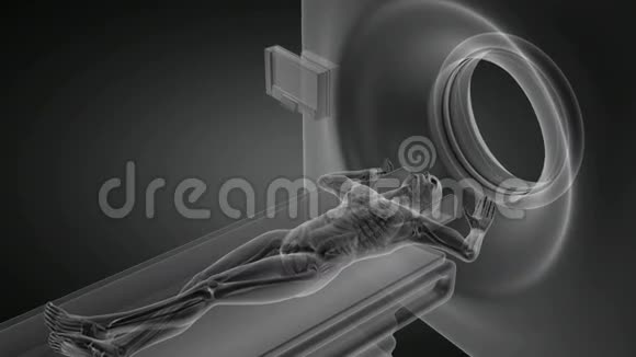 核磁共振检查台上的人视频的预览图