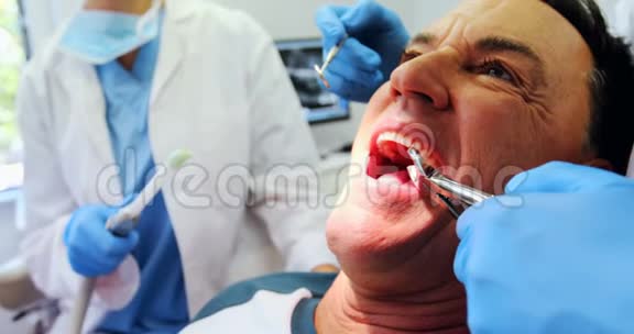 牙医用工具检查男性病人视频的预览图