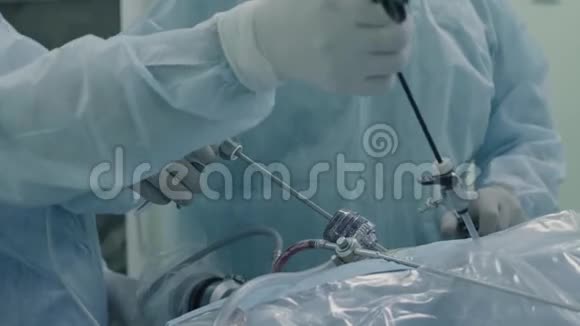 腹部腹腔镜手术视频的预览图