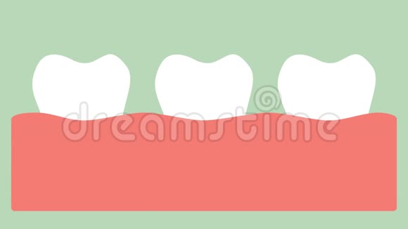 牙龈炎或牙龈病牙周病前牙龈炎视频的预览图