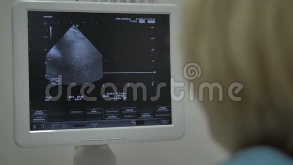 在医生的肩膀上有一个超声波检查视频的预览图