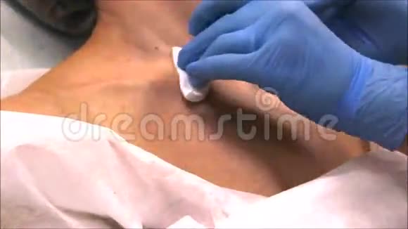 皮肤科医生在美容手术前用肉毒杆菌毒素消毒颈部皮肤视频的预览图